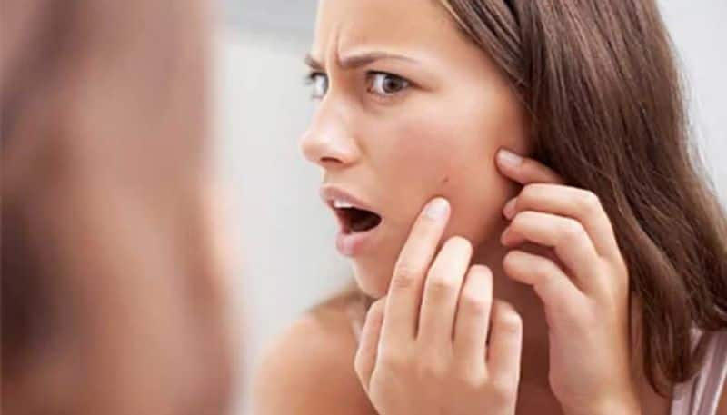 how to remove pimple scars