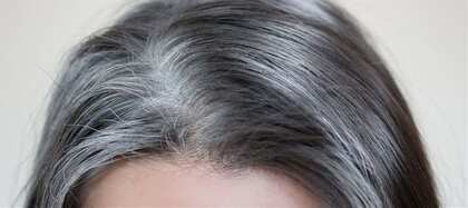 Reverse Grey Hair Naturally