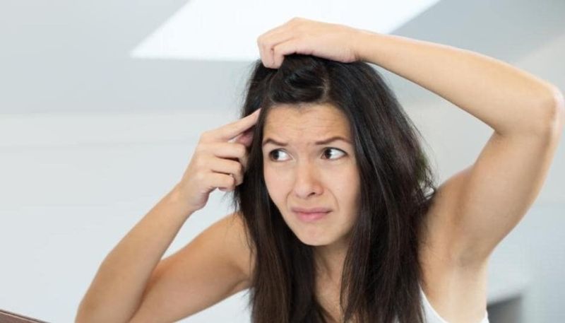 how to reduce dandruff in home