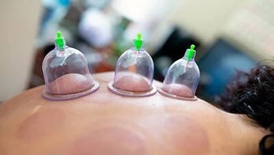 Cupping therapy: शरीर से खून निकालकर खुद को खूबसूरत बनाने सेलेब्रिटी लेते है दर्दनाक थेरेपी, जानिए इसके फायदे