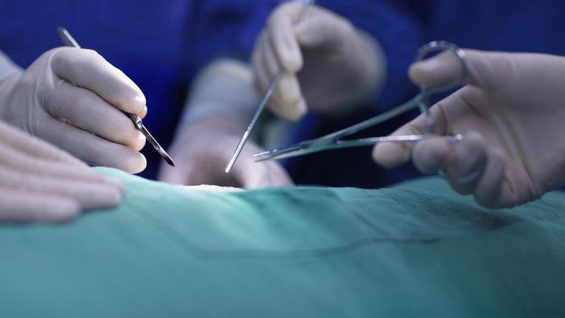 Doctors remove whistle stuck for 11 months inside lungs of 12 -year old