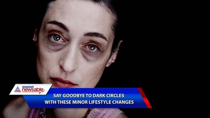 Say goodbye to dark circles with these minor lifestyle changes-dnm