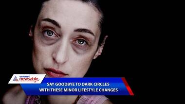 Say goodbye to dark circles with these minor lifestyle changes