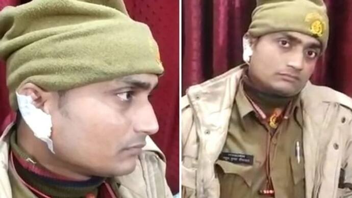 लखनऊ: दो पक्षों का विवाद सुलझाने पहुंची पुलिस, दबंगों ने सिपाही का काटा कान, आरोपियों की तलाश में जुटी पुलिस