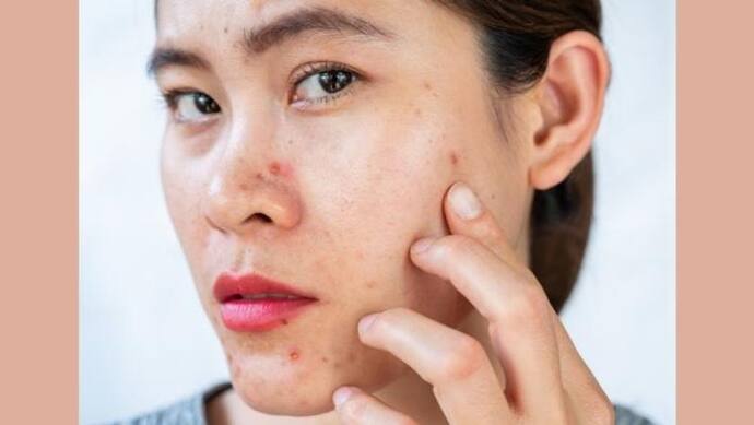 Skin Problem: प्रेगनेंसी के दौरान अगर आप भी हैं स्किन की प्रॉब्लम से परेशान, तो ऐसे रखें अपना ध्यान