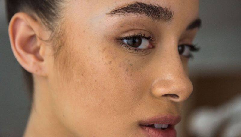 try these facepacks to get rid of dark spots