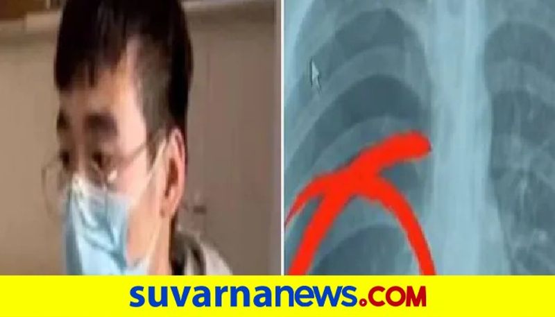 Man In China Suffers Collapsed Lung After Singing His Heart Out During Karaoke pod