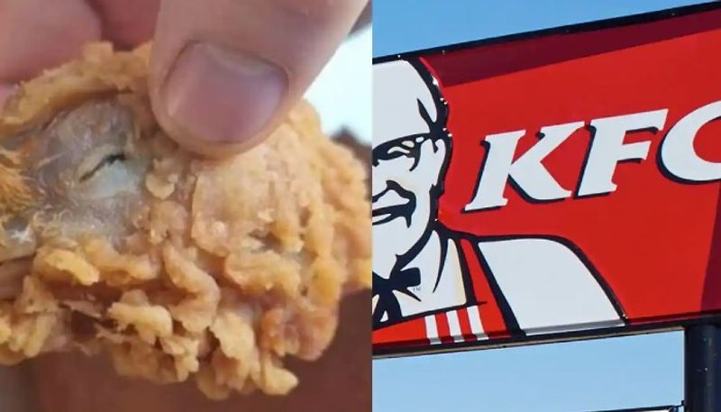 woman got chicken head from kfc meal box