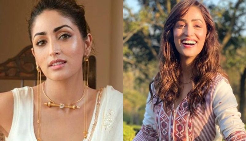 Yami Gautam reveals peoples reaction to her skin condition during shoots