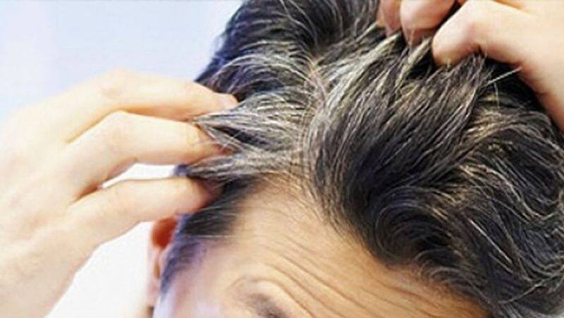 home remedies for premature grey hair