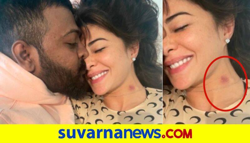 Jacqueline Fernandez photo with Sukesh Chandrasekhar surfaces online shows love bite dpl