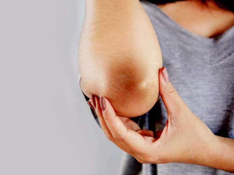 Hyperpigmentation: Five simple tricks to get rid of uneven skin tone 