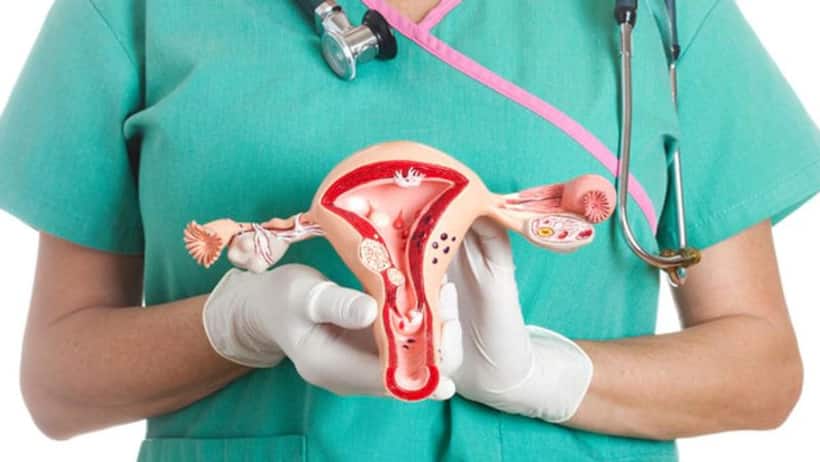 Here are 7 myths around Cervical Cancer