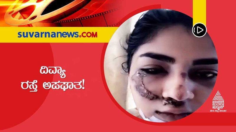 Bigg Boss fame Divya Suresh met with an accident to avoid street dogs  vcs