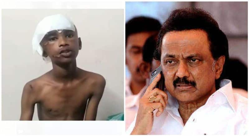 DMK government's plan-surviving boy longs to talk to the chief .. Stalin who gave a surprise.! Video inside