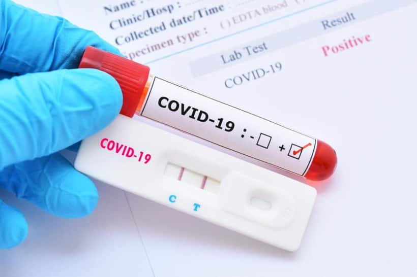 Covid 19 test : క‌రోనావైర‌స్ కొత్త పరీక్ష.. ఇక గంట‌ల్లోనే అన్ని వేరియంట్ల గుర్తింపు.. ! 