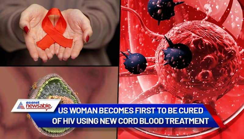 US woman becomes first to be cured of HIV using umbilical cord blood treatment