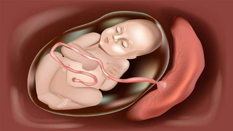 dont sleep in this position the umbilical cord wrapped around the baby neck in tamil mks