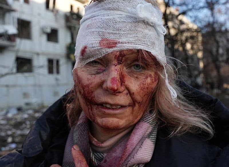 Russia Ukraine crisis Humans of Ukraine: Scarred, jolted yet resilient