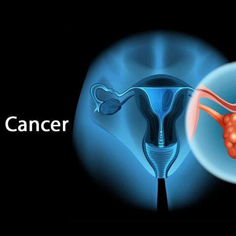 Understanding the risk factors of ovarian cancer: What increases your risk and why