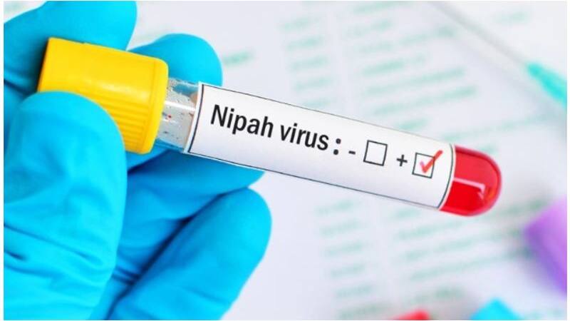 nipah virus