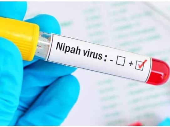 2 Deaths In Kerala Due To Nipah Virus KRJ