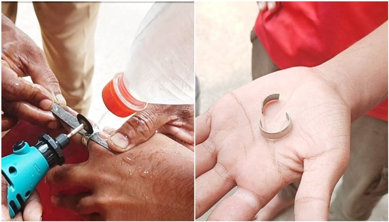 Fire fighters pull out a Chinese ring stuck in a finger