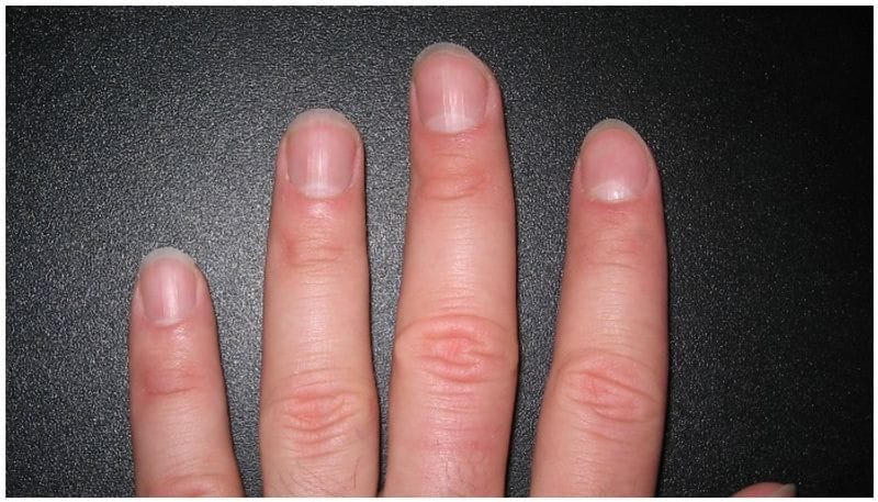 Do check your nails indicates this auspicious or inauspicious sign