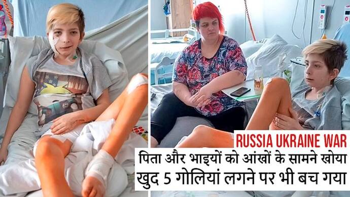 Russia Ukraine War:आंखों के सामने पिता को तड़पकर मरते देखा, खुद भी लगी 5 गोलियां, बच तो गया, मगर...