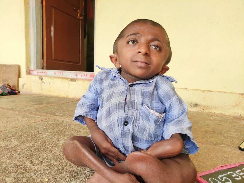 Dwarf Faces Helplessness of the Fathers Difficulty in Bagalkot grg