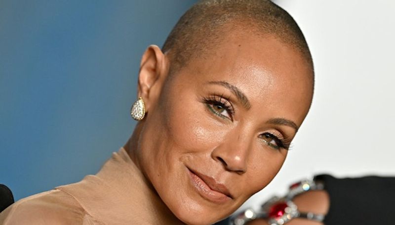 What is Alopecia Areata the hair loss disorder Will Smith wife Jada Pinkett Smith suffering from drb