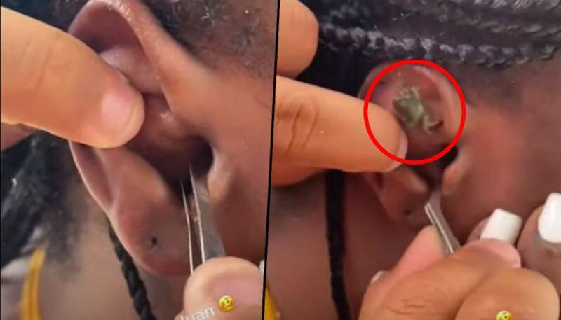 Crab gets stuck inside woman's ear while snorkelling; find out what happens next - gps