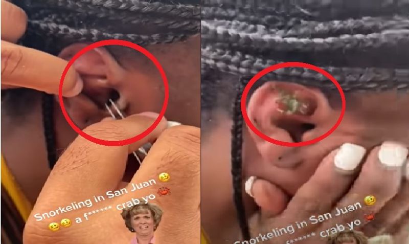 crab stuck on womens ear and video gone viral