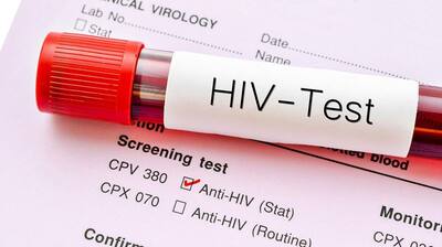 World AIDS vaccine day 2022: Here are ways to prevent yourself from getting HIV