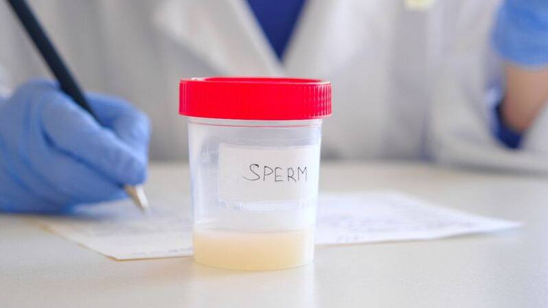 sperm