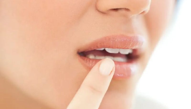 kissing causes many oral infections here is things to know