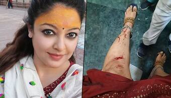 Tanushree Dutta ‘prayed for no broken bones’ after ‘freak accident’; sustains stitches