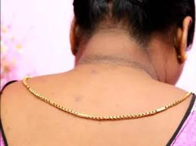 how to remove neck darkness naturally rsl