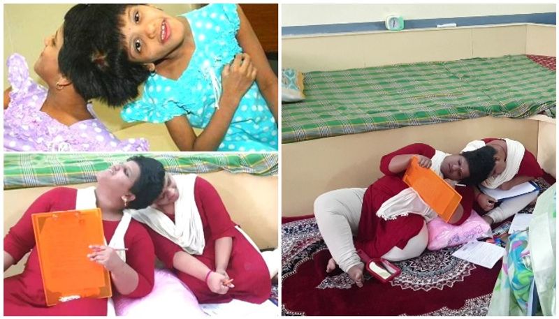 Conjoined Twins Appear For Class 12 Exams