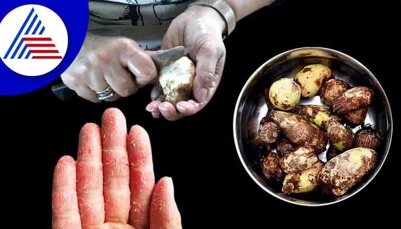 Kitchen tips to avoid itching while peeling arbhi