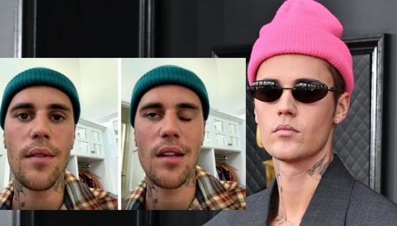 Singer Justin Bieber diagnosed with Ramsay Hunt syndrome, says half his face is paralyzed