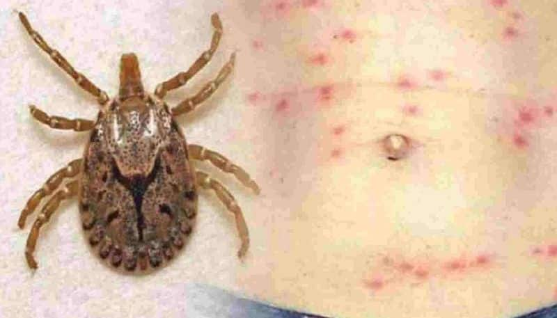 All you need to know about Scrub typhus