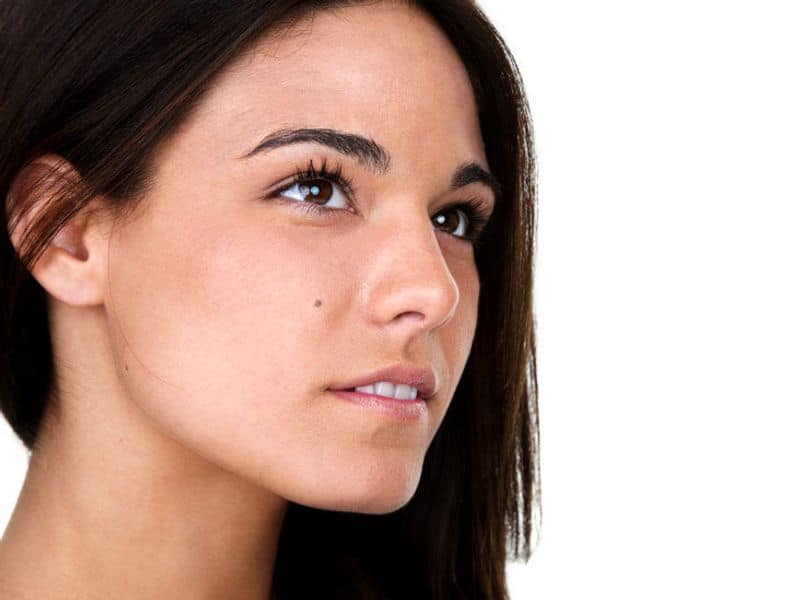 how to cure melasma permanently at home