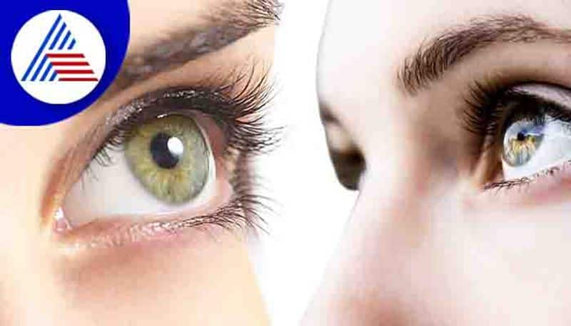 Simple home remedies for swollen eyelid