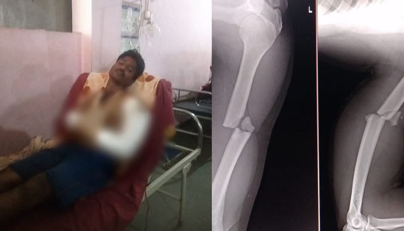 Belagavi forest department employee seeks help who suffered fracture during rescue operation mnj 