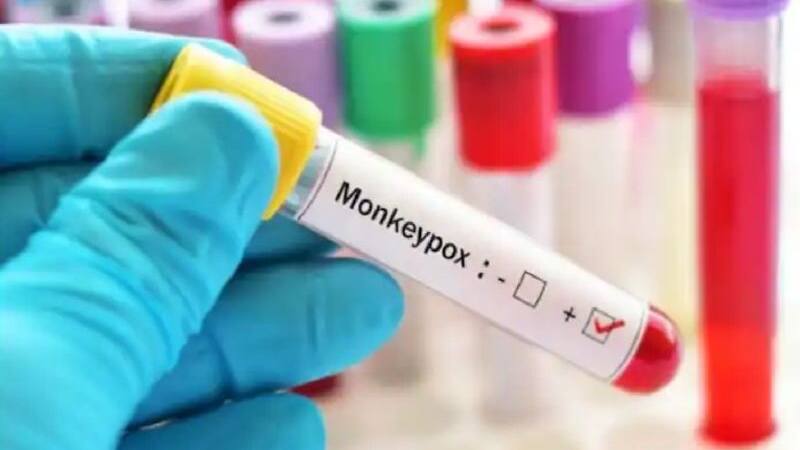 Bangla_Money_Pox