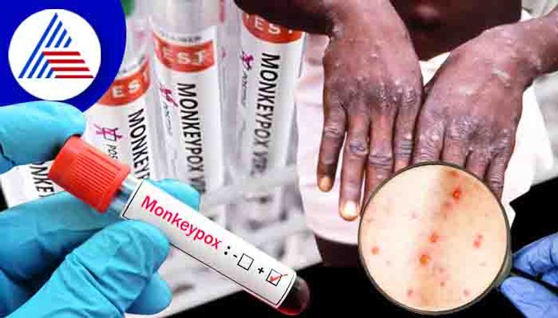 Mpox outbreak in Africa is public health emergency, declares WHO (WATCH) snt