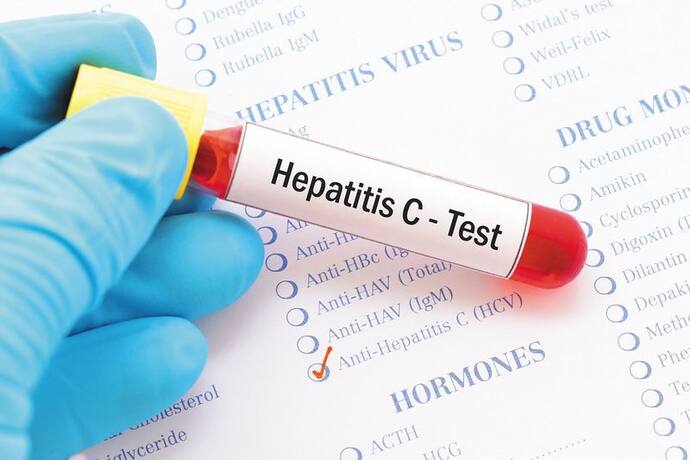 hepatitis c