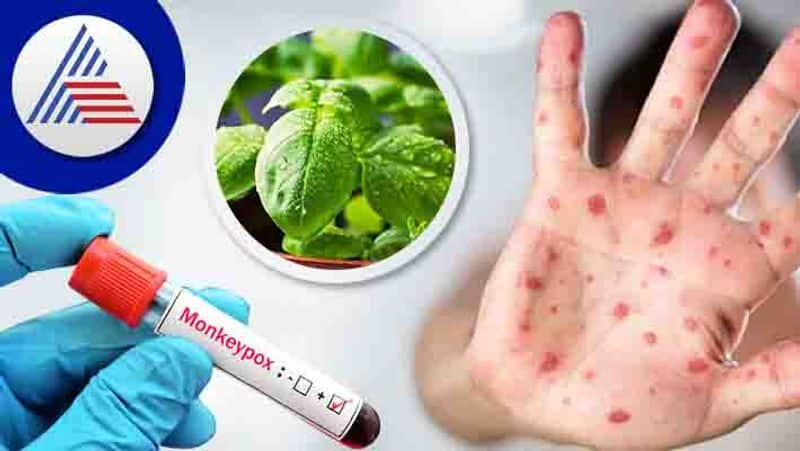 Foods That Can Help In Better Recovery Of Monkeypox Vin