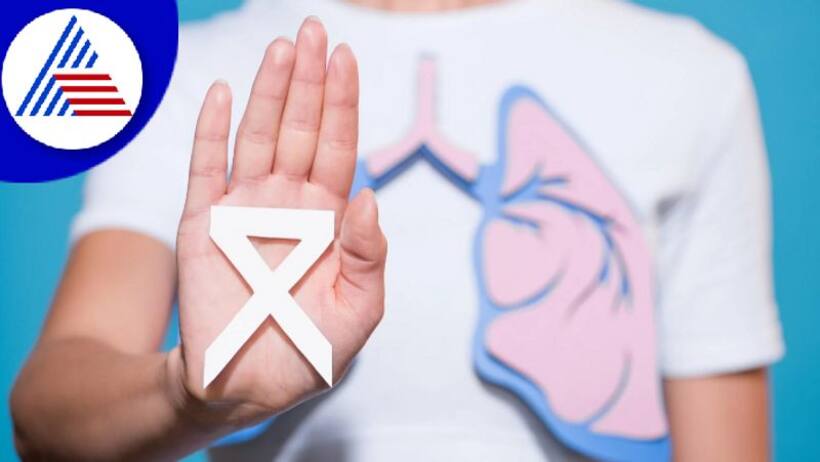 Lung Cancer: Cure rate can be as high as 80% to 90% if detected in early stage
